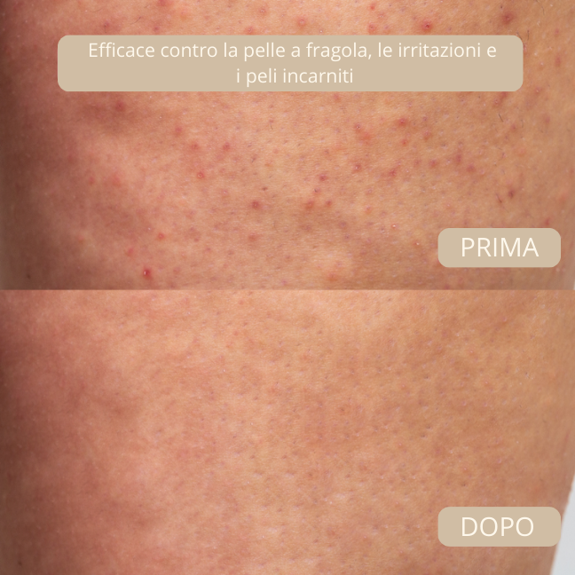 Dermia Pro Beauty Kit – Edizione Completa