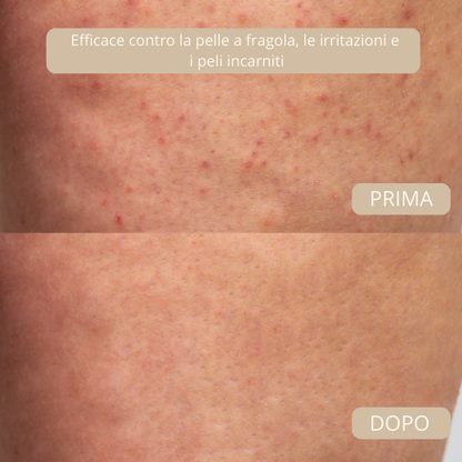 Dermia Pro Beauty Kit – Edizione Completa