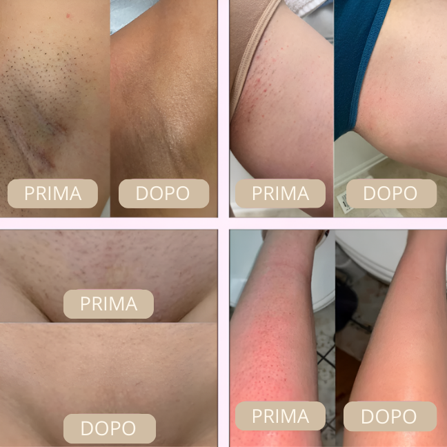 Dermia Pro Beauty Kit – Edizione Completa