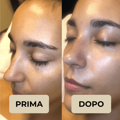 Peel Shot Coreano – Elimina le impurità e sublima la tua pelle