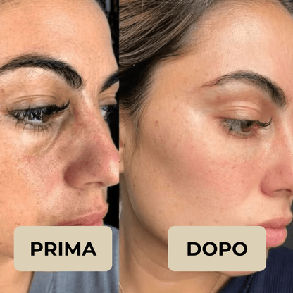 Peel Shot Coreano – Elimina le impurità e sublima la tua pelle