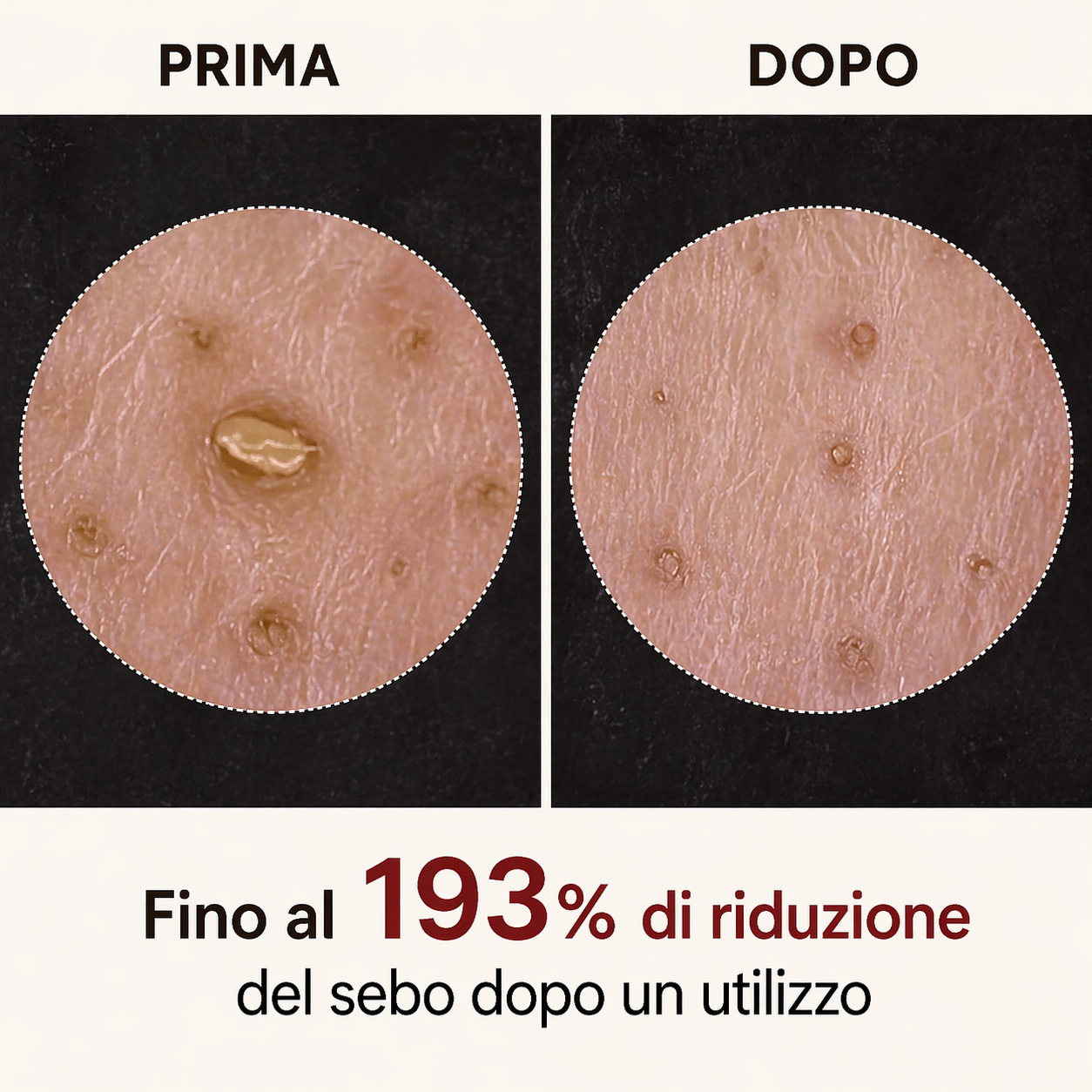 Peel Shot Coreano – Elimina le impurità e sublima la tua pelle