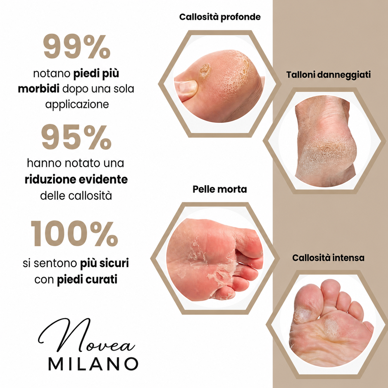 Novea - Kit Bellezza Piedi