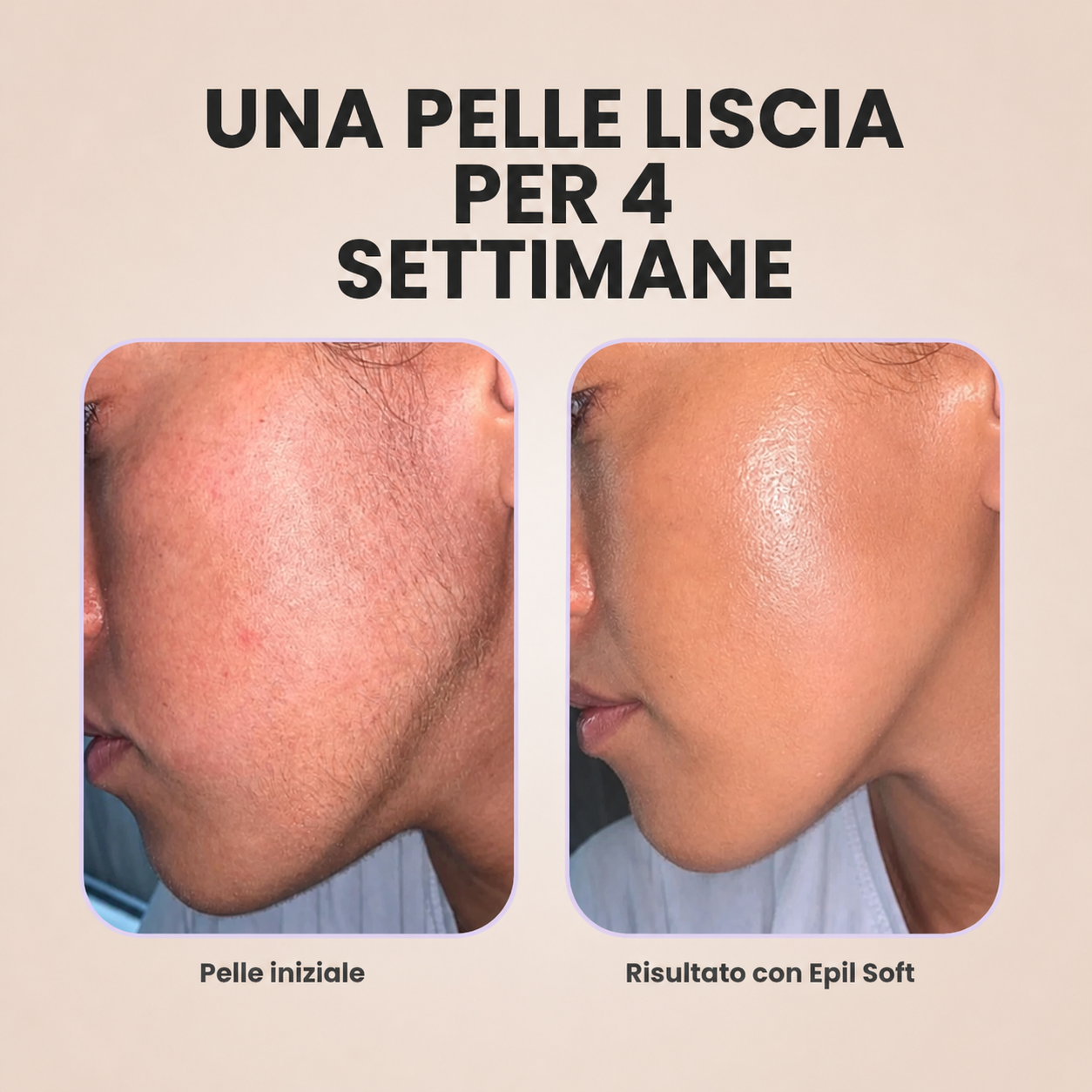 EpilSoft - Il tuo nuovo epilatore per il viso