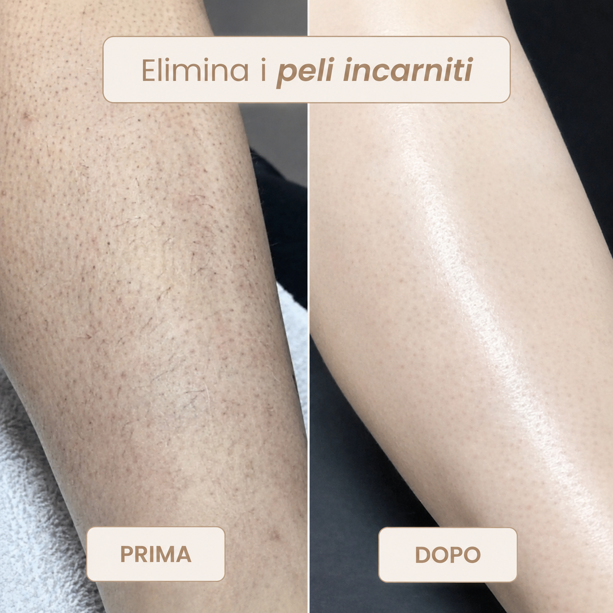 Rasoio Novea – Addio Peli Incarniti e Irritazioni per il Corpo