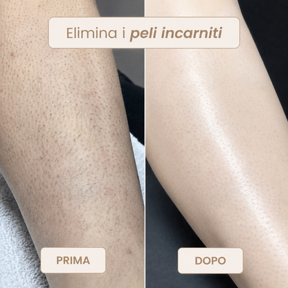 Rasoio Novea – Addio Peli Incarniti e Irritazioni per il Corpo