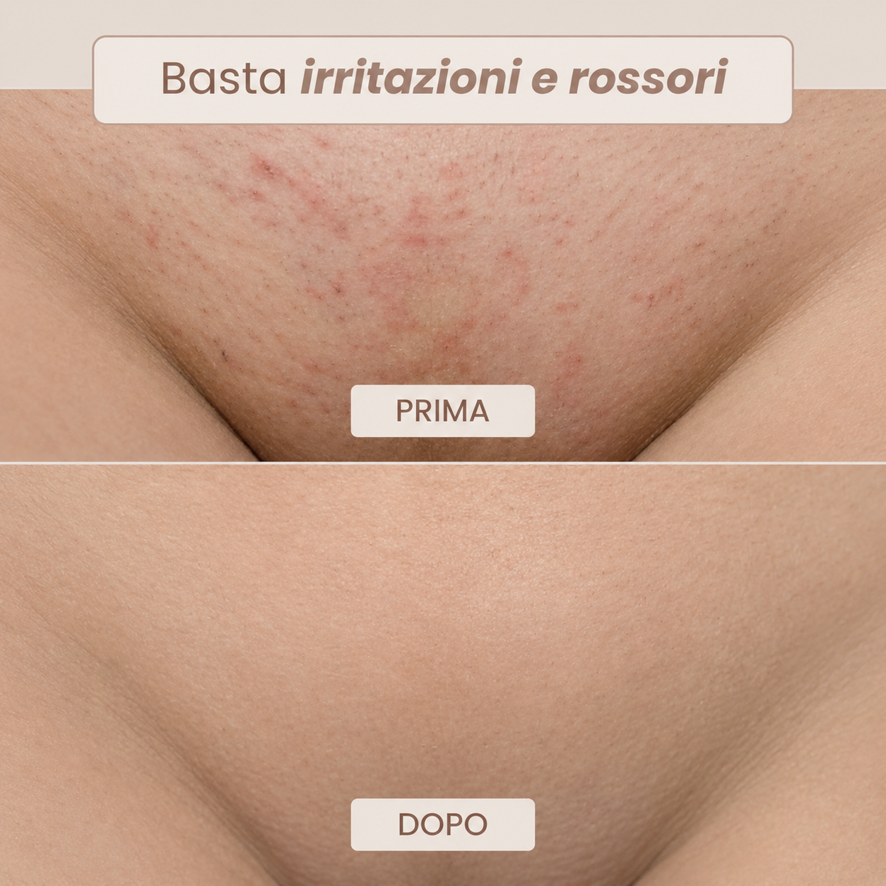 Rasoio Novea – Addio Peli Incarniti e Irritazioni per il Corpo