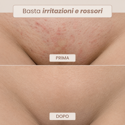 Rasoio Novea – Addio Peli Incarniti e Irritazioni per il Corpo